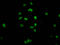 Histone Cluster 1 H1 Family Member E antibody, LS-C670383, Lifespan Biosciences, Immunofluorescence image 