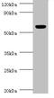 Cholinergic Receptor Nicotinic Alpha 1 Subunit antibody, A53586-100, Epigentek, Western Blot image 