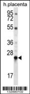 LHFPL Tetraspan Subfamily Member 1 antibody, 56-914, ProSci, Western Blot image 