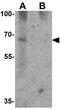 Guanylate-binding protein 5 antibody, GTX31537, GeneTex, Western Blot image 