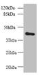 Zinc Finger DHHC-Type Containing 4 antibody, orb357679, Biorbyt, Western Blot image 