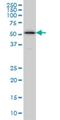 Zinc finger protein ZPR1 antibody, H00008882-M01, Novus Biologicals, Western Blot image 