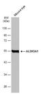 Aldehyde Dehydrogenase 3 Family Member A1 antibody, NBP2-15340, Novus Biologicals, Western Blot image 