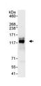 DAB2 Interacting Protein antibody, ab87811, Abcam, Immunoprecipitation image 