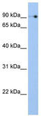 NOC3 Like DNA Replication Regulator antibody, TA339358, Origene, Western Blot image 