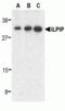 STE20 Related Adaptor Beta antibody, TA306143, Origene, Western Blot image 