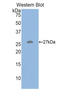 Hepatocyte Growth Factor antibody, LS-C294476, Lifespan Biosciences, Western Blot image 