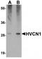 HVCN1 antibody, TA320047, Origene, Western Blot image 