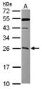 Coiled-Coil Domain Containing 90B antibody, NBP2-15756, Novus Biologicals, Western Blot image 