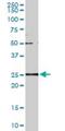 Glutathione S-transferase A2 antibody, H00002939-M05, Novus Biologicals, Western Blot image 