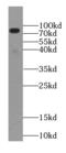Neuronal Guanine Nucleotide Exchange Factor antibody, FNab05720, FineTest, Western Blot image 