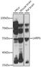 La Ribonucleoprotein Domain Family Member 6 antibody, 16-555, ProSci, Western Blot image 