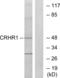 Corticotropin-releasing factor receptor 1 antibody, abx015227, Abbexa, Western Blot image 