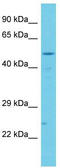 Centrosomal protein of 83 kDa antibody, TA330648, Origene, Western Blot image 