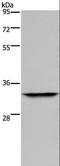 Acidic Nuclear Phosphoprotein 32 Family Member E antibody, LS-C406523, Lifespan Biosciences, Western Blot image 