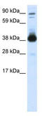 Forkhead Box H1 antibody, TA341763, Origene, Western Blot image 