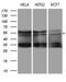 DEAD-Box Helicase 19A antibody, LS-C795216, Lifespan Biosciences, Western Blot image 