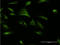 Cyclic AMP-dependent transcription factor ATF-6 beta antibody, LS-C196961, Lifespan Biosciences, Immunofluorescence image 