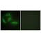 Cyclin Dependent Kinase Like 4 antibody, A16582, Boster Biological Technology, Immunohistochemistry paraffin image 
