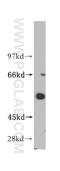 Inositol-Trisphosphate 3-Kinase A antibody, 14270-1-AP, Proteintech Group, Western Blot image 