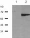 Estrogen Receptor 1 antibody, TA321066, Origene, Western Blot image 