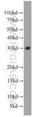 WAP Four-Disulfide Core Domain 1 antibody, 13204-1-AP, Proteintech Group, Western Blot image 