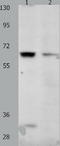 Potassium Voltage-Gated Channel Subfamily C Member 2 antibody, TA322053, Origene, Western Blot image 