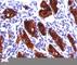 Thyroglobulin antibody, V2262IHC-7ML, NSJ Bioreagents, Immunohistochemistry paraffin image 