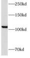 Angiomotin Like 1 antibody, FNab00369, FineTest, Western Blot image 