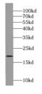 ADP-ribosylation factor-like protein 6 antibody, FNab00817, FineTest, Western Blot image 