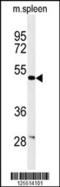 Coronin 6 antibody, 61-678, ProSci, Western Blot image 