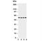 Solute Carrier Family 2 Member 5 antibody, R31175, NSJ Bioreagents, Western Blot image 