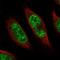 PHD Finger Protein 20 Like 1 antibody, NBP1-84501, Novus Biologicals, Immunofluorescence image 
