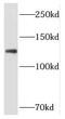 Protein Phosphatase 1 Regulatory Subunit 9B antibody, FNab06711, FineTest, Western Blot image 