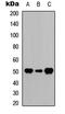 GFAP antibody, LS-C358771, Lifespan Biosciences, Western Blot image 