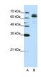 FMR1 Autosomal Homolog 1 antibody, orb330102, Biorbyt, Western Blot image 