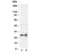 Fibroblast Growth Factor 8 antibody, R30317, NSJ Bioreagents, Western Blot image 