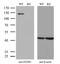 Fibroblast Growth Factor Receptor 3 antibody, MA5-26493, Invitrogen Antibodies, Western Blot image 