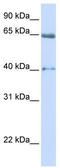 Voltage-dependent L-type calcium channel subunit beta-2 antibody, TA339046, Origene, Western Blot image 