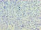 Inactive phospholipase D5 antibody, LS-C319062, Lifespan Biosciences, Immunohistochemistry paraffin image 