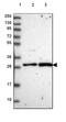 Centromere protein Q antibody, HPA046634, Atlas Antibodies, Western Blot image 