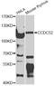 Spindle And Centriole Associated Protein 1 antibody, LS-C747706, Lifespan Biosciences, Western Blot image 