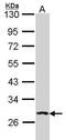 Dual Specificity Phosphatase 2 antibody, GTX108252, GeneTex, Western Blot image 