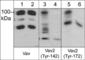 Vav Guanine Nucleotide Exchange Factor 1 antibody, VP2481, ECM Biosciences, Western Blot image 