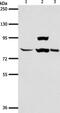 ArfGAP With GTPase Domain, Ankyrin Repeat And PH Domain 1 antibody, PA5-50542, Invitrogen Antibodies, Western Blot image 