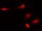 CDKN2A antibody, GTX02312, GeneTex, Immunocytochemistry image 