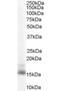 Retinol Binding Protein 1 antibody, orb18987, Biorbyt, Western Blot image 