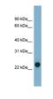 ADP Ribosylation Factor Like GTPase 17B antibody, orb326085, Biorbyt, Western Blot image 