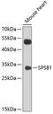 SplA/Ryanodine Receptor Domain And SOCS Box Containing 1 antibody, 13-581, ProSci, Western Blot image 
