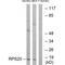 Ribosomal Protein S20 antibody, A06634, Boster Biological Technology, Western Blot image 